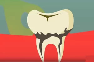 芝麻学社-少儿护牙必修课